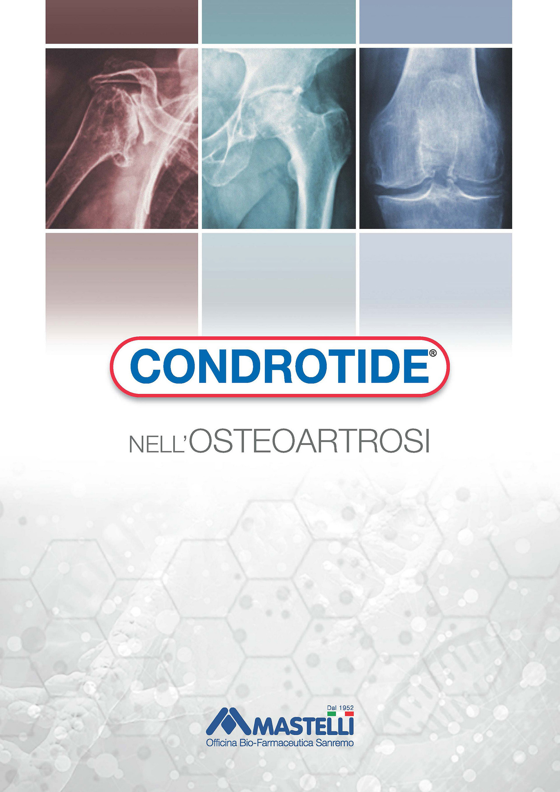 Condrotide