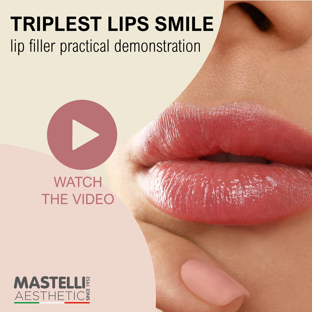 triplest lips smile
